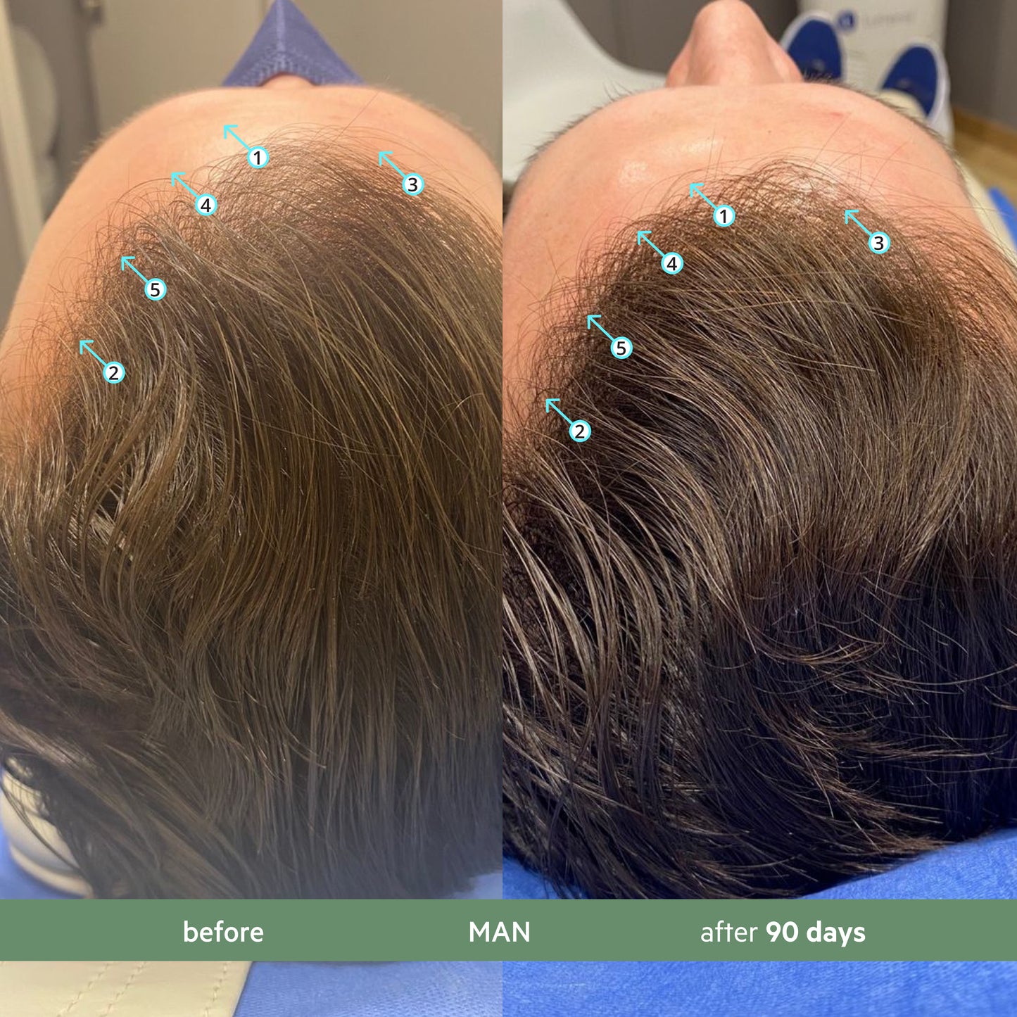 Revita.CBD | Super Antioxidant Hair DENSITY CBD Shampoo