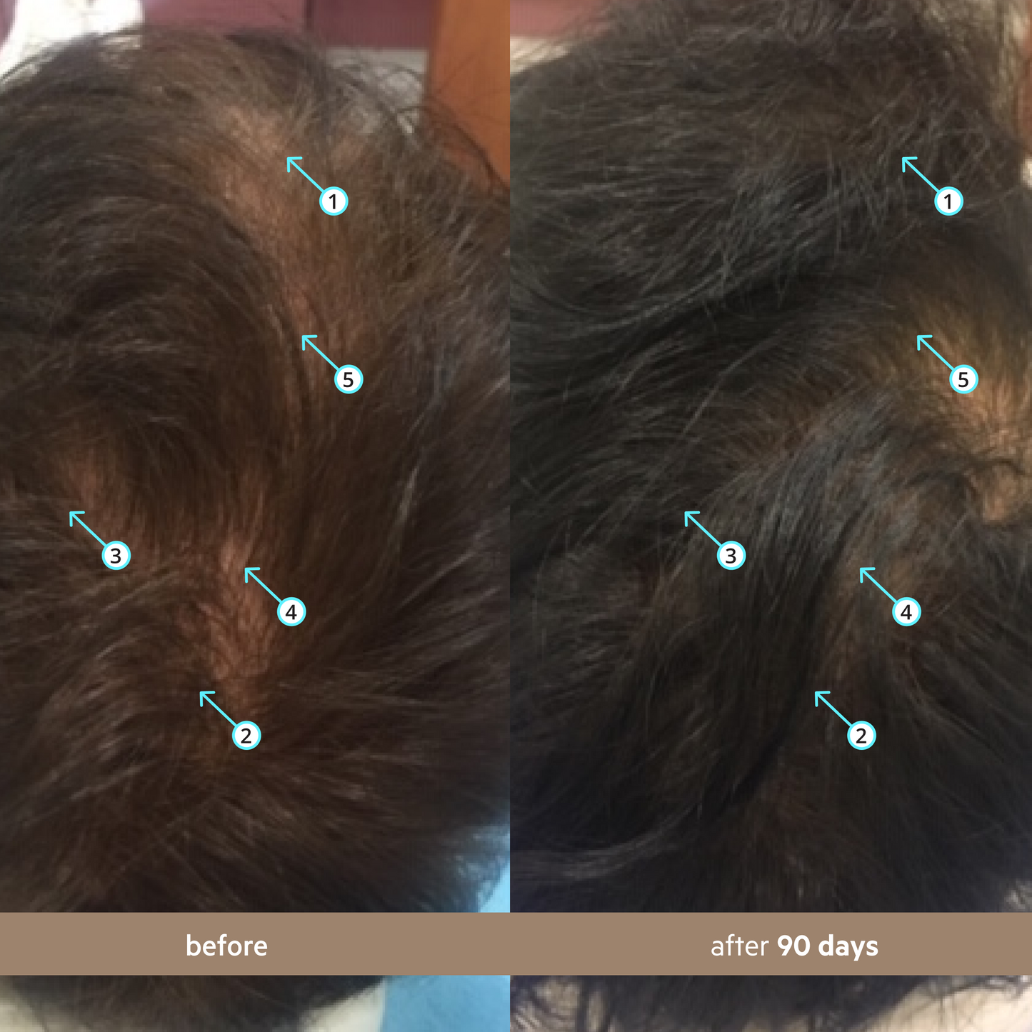 Men's Hair Density Kit PLUS | Revita Shampoo/Conditioner+ Spectral Men's + Revita Tablets®