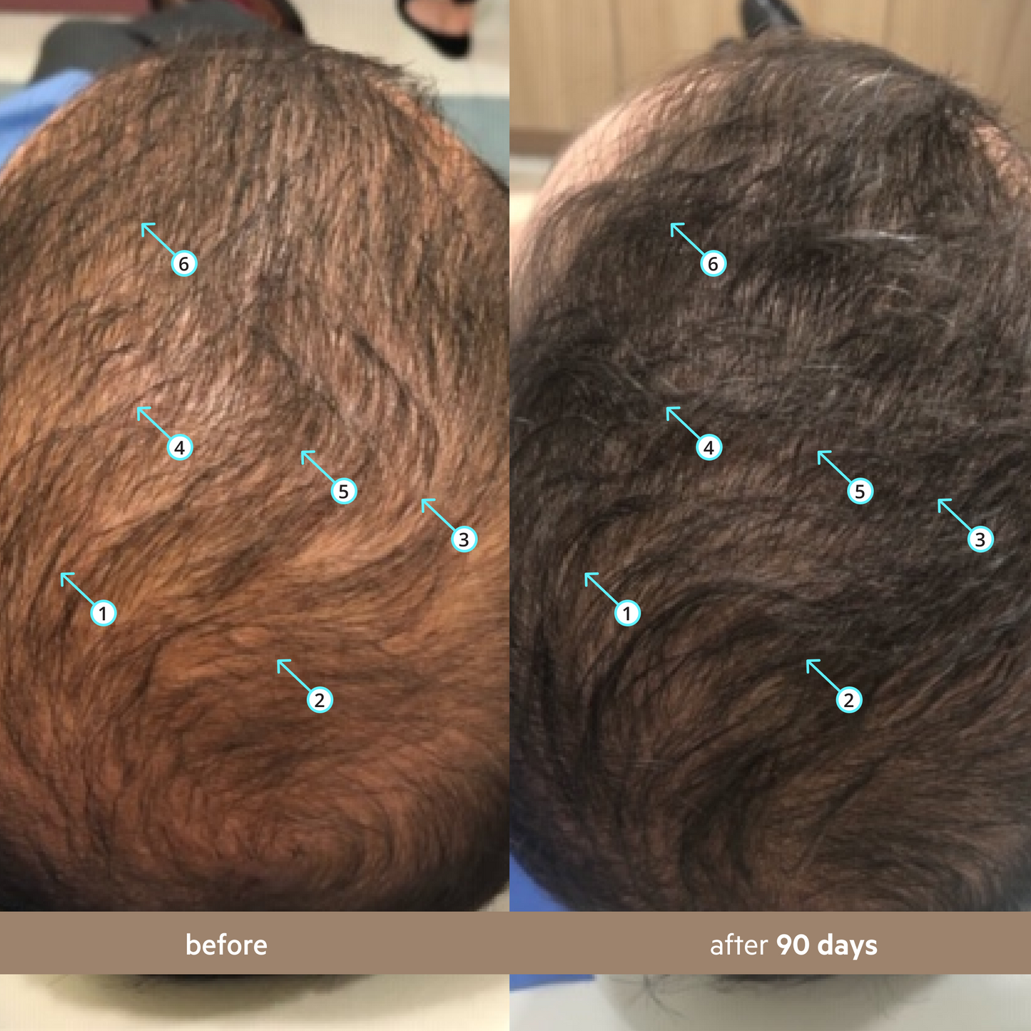 Men's Hair Density Kit PLUS | Revita Shampoo/Conditioner+ Spectral Men's + Revita Tablets®