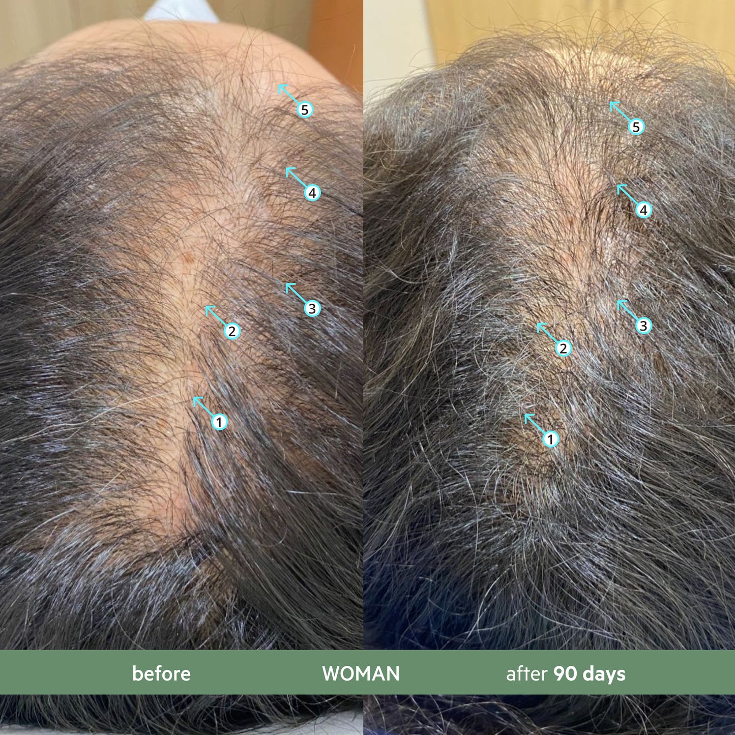 Revita.CBD | Super Antioxidant Hair DENSITY CBD Shampoo