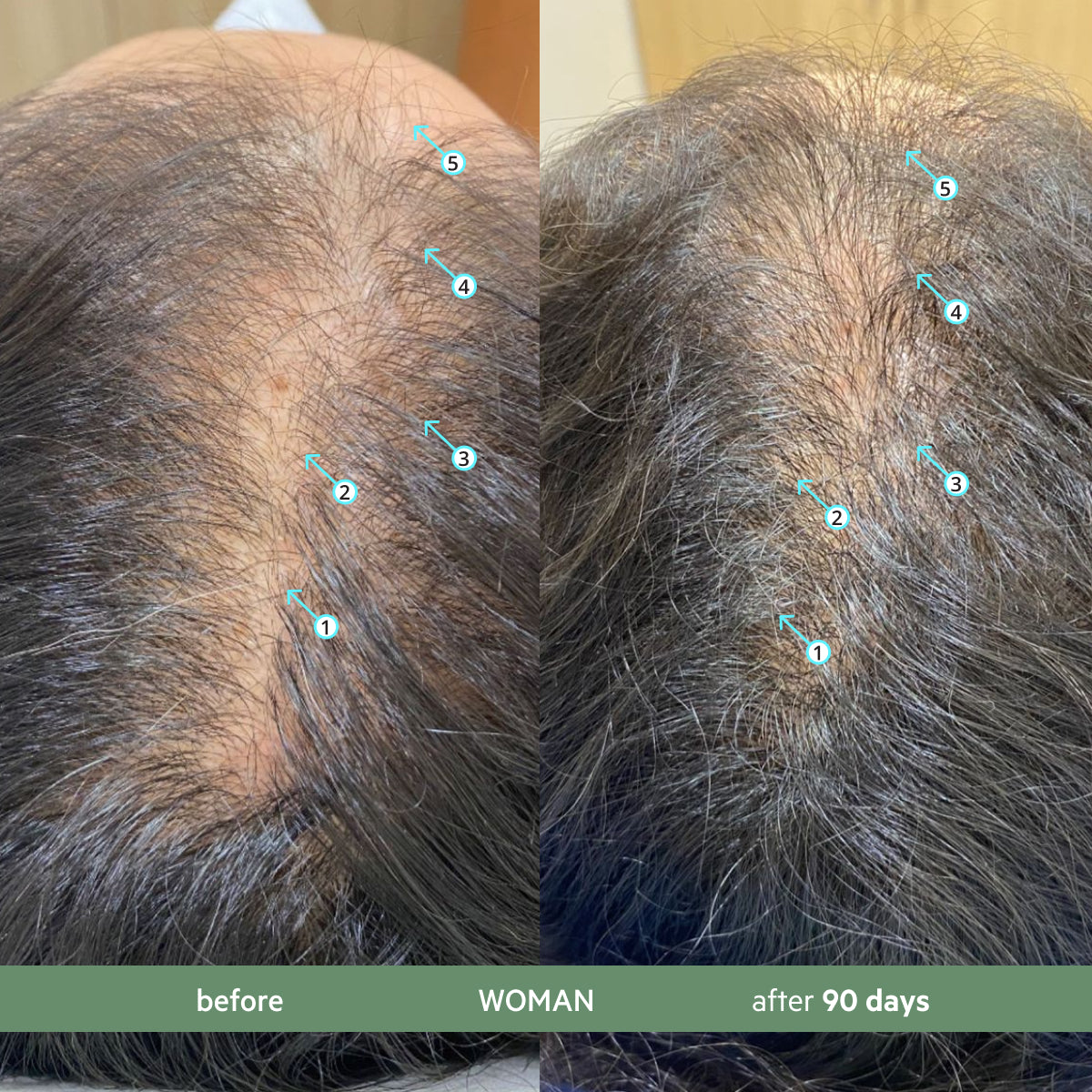 CBD Hair Density Kit