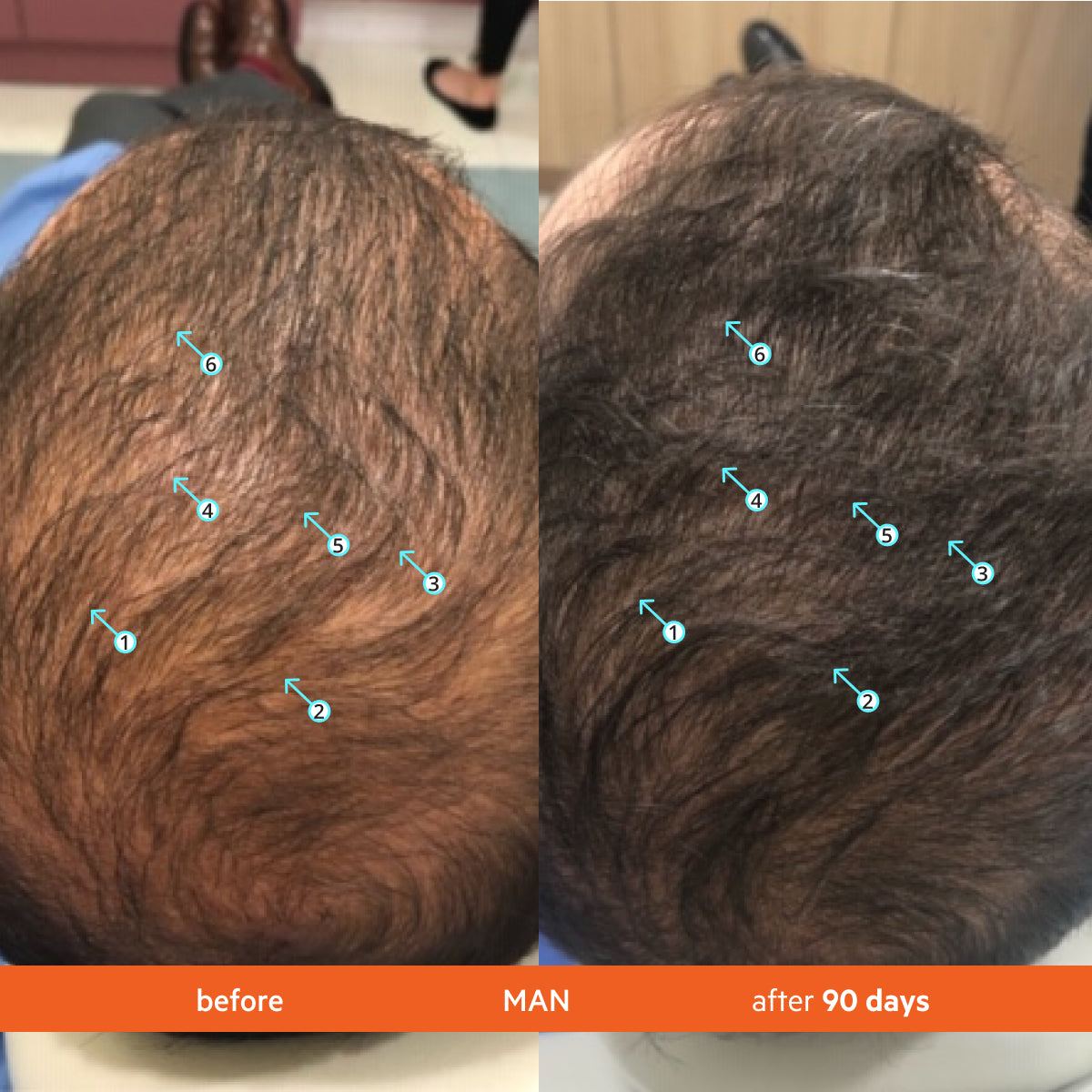 Complete Hair Revival | Transformation Bundle