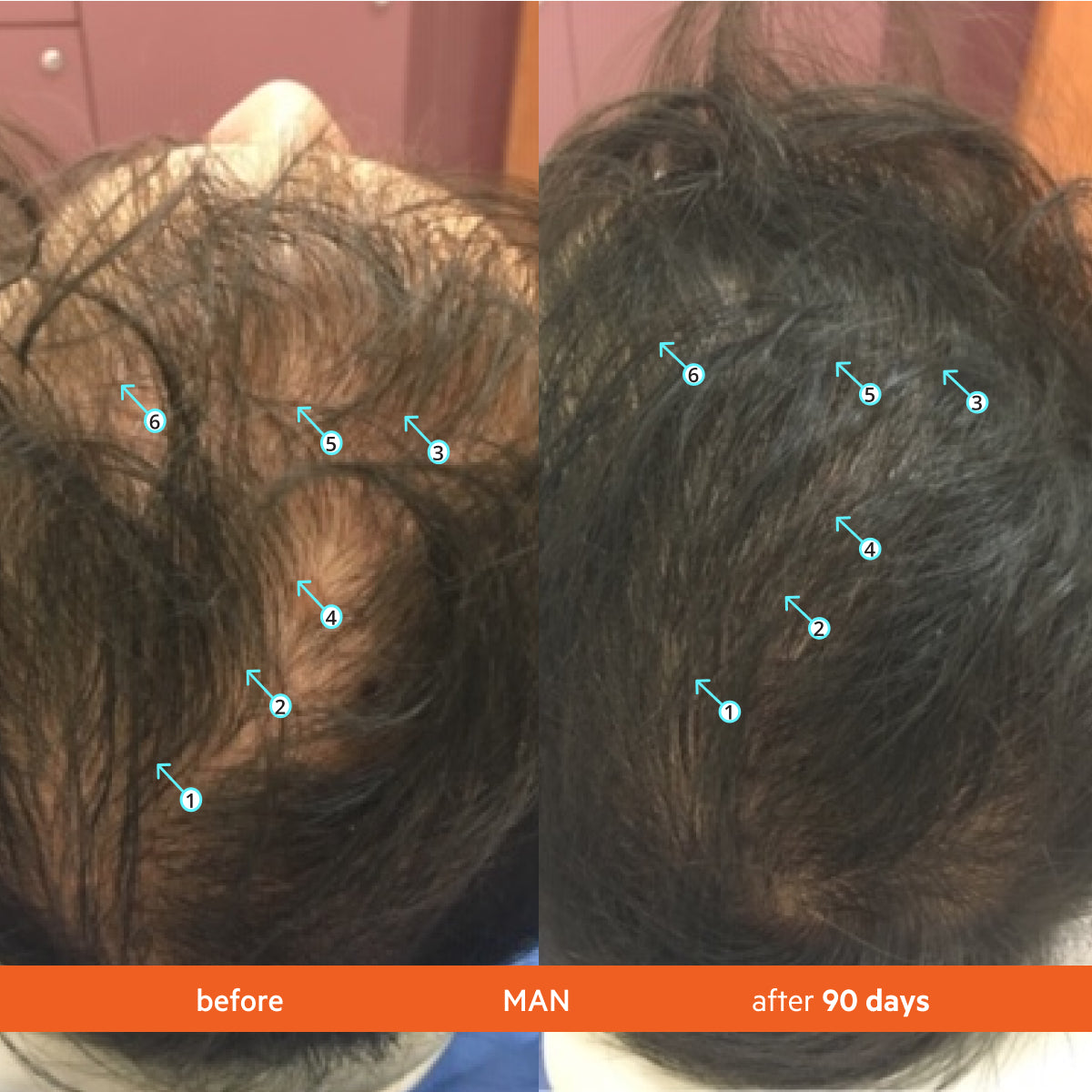 Revita | TABLETS FOR HAIR GROWTH SUPPORT