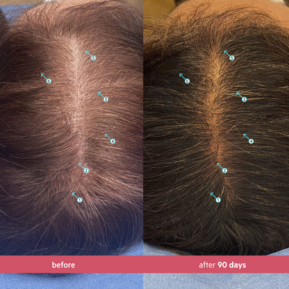 Spectral Women's (CSF) | Revitalizing Serum for Women with Nanoxidil 5%
