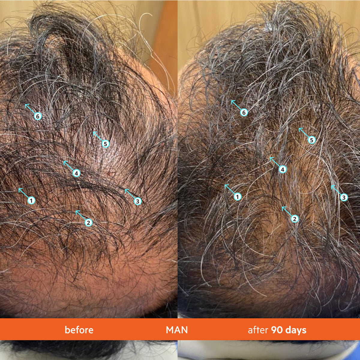 Men's Hair Density Kit | Revita Shampoo/Conditioner + Men's