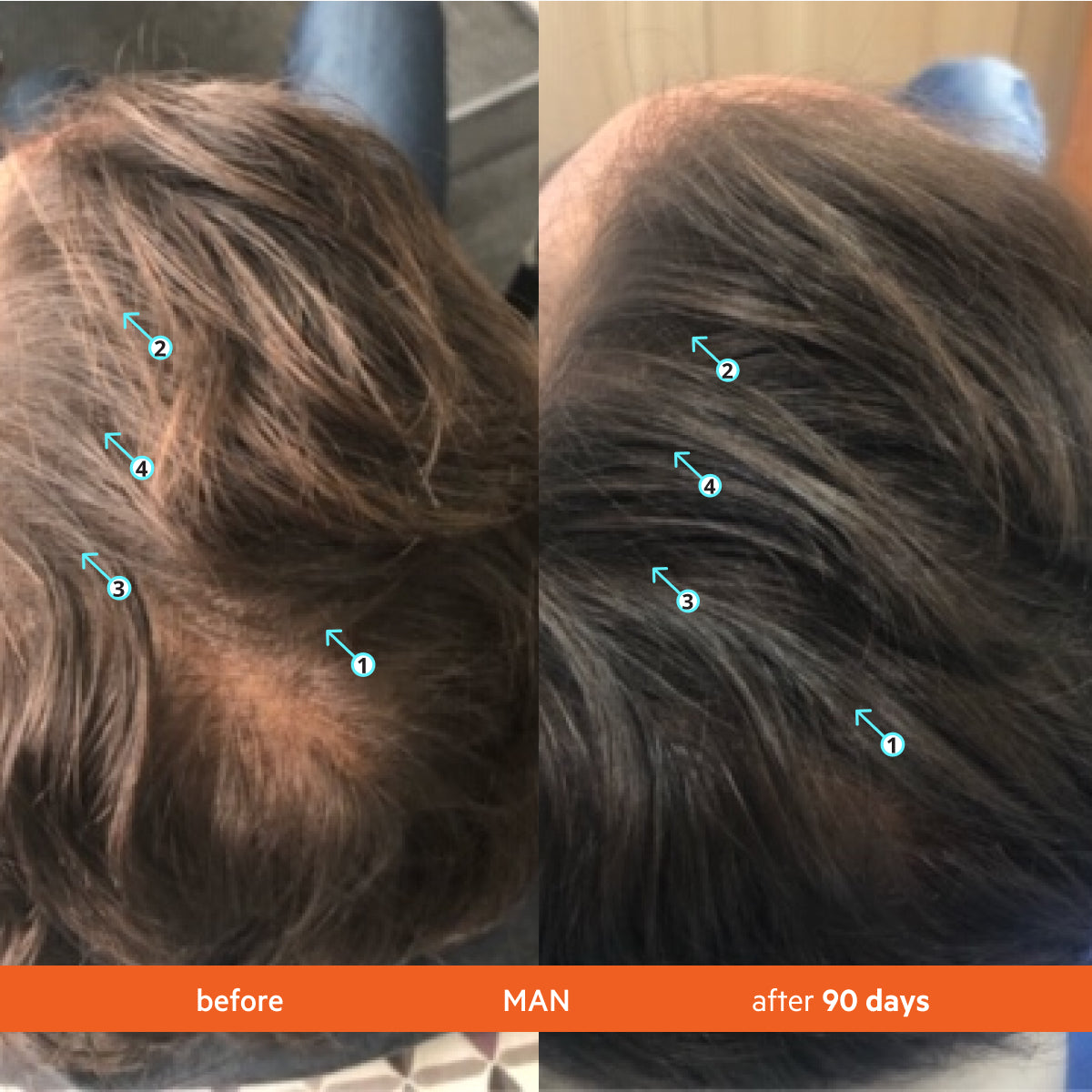 Men's Hair Density Kit | Revita Shampoo/Conditioner + Men's