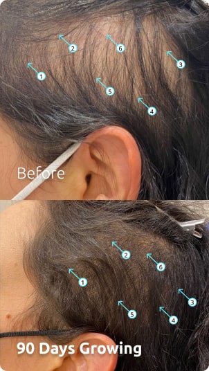 image-before-after