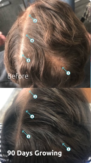 image-before-after
