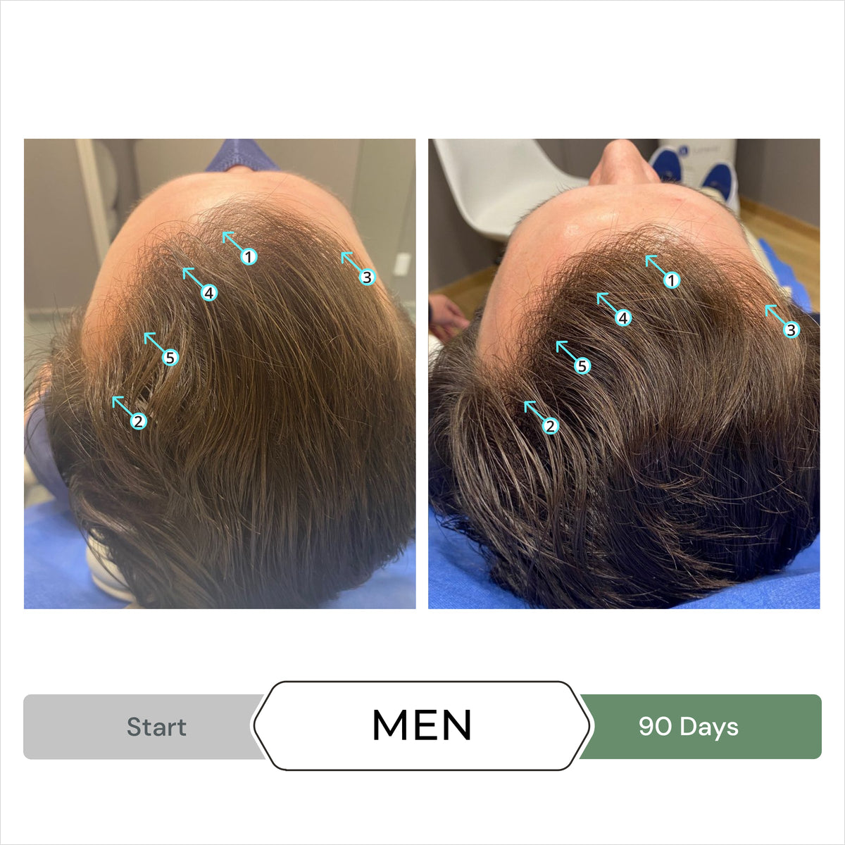 REVITA.CBD® | ANTIOXIDANT HAIR DENSITY CBD CONDITIONER  500ml