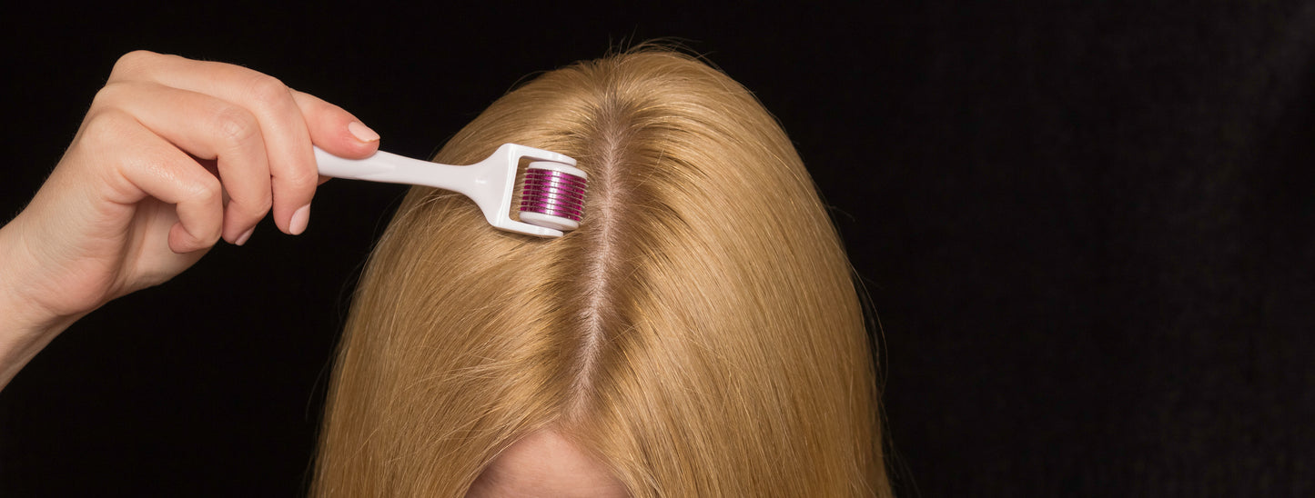 Does Microneedling Enhance the Effects of Minoxidil on Hair Growth?