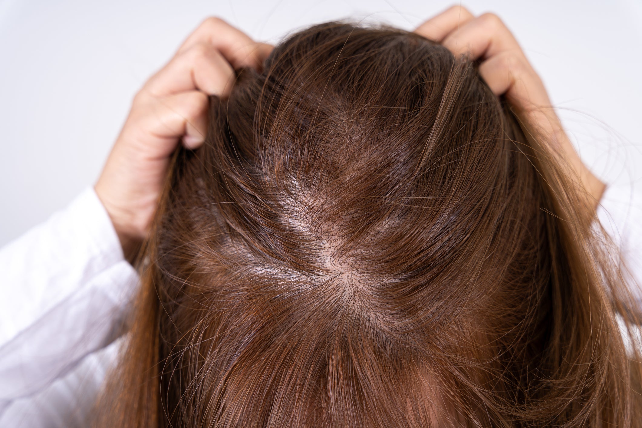 How a Dry Scalp Can Lead to Hair Loss DS Healthcare Group