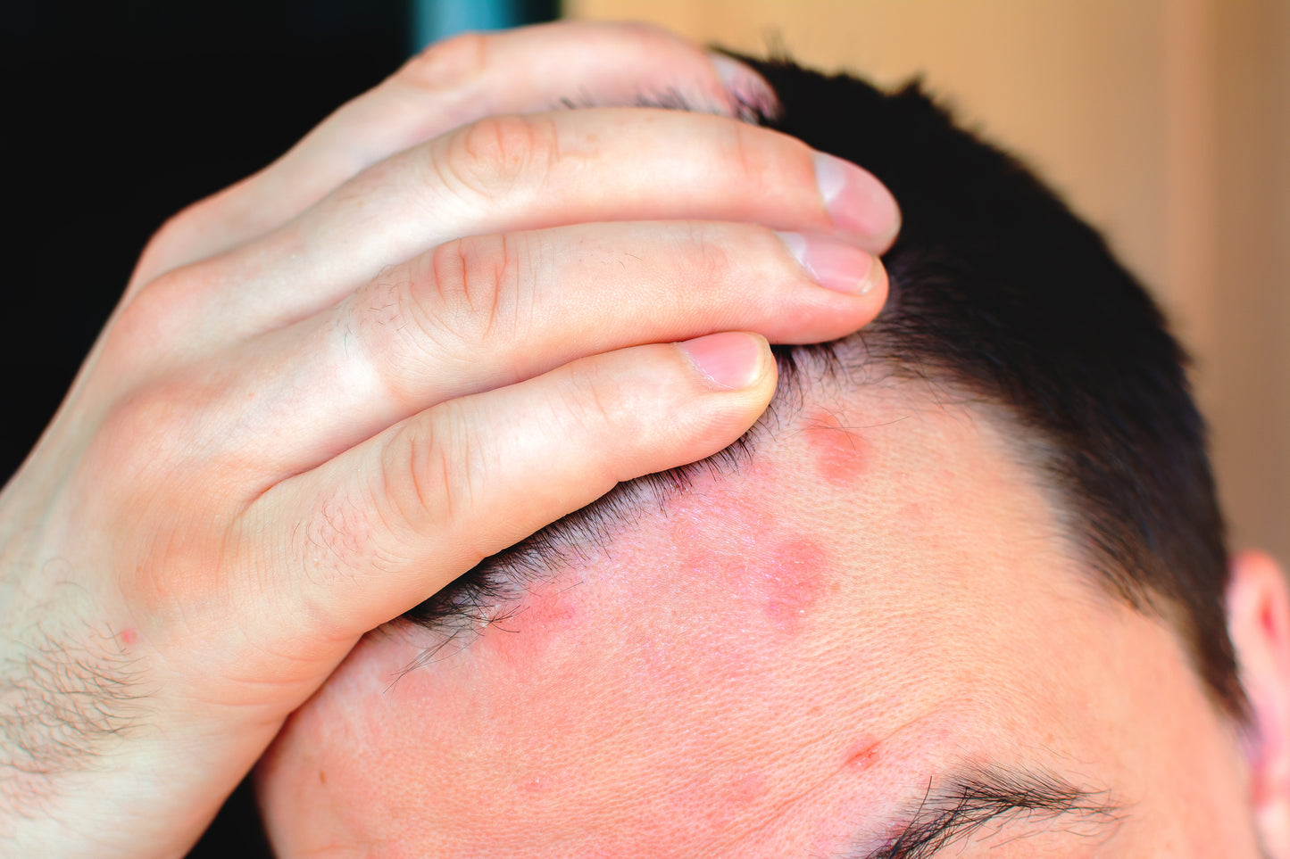 Scalp Problems You Shouldn't Ignore