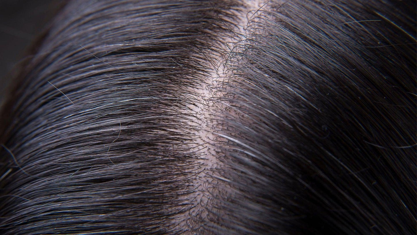 Why Your Hair Looks Thinner Even If You’re Healthy