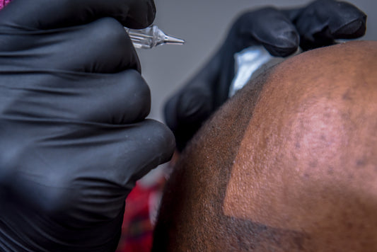 What is the approximate cost of scalp micropigmentation?