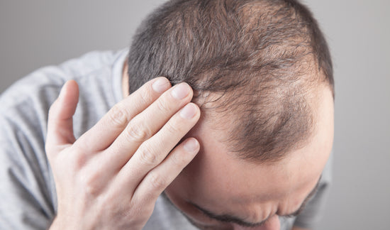 Does Crohn's Disease Cause Hair Loss?