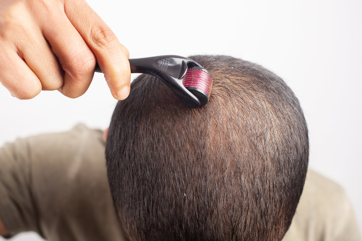 How Often Should You Use a Derma Roller for Hair Loss? – DS Healthcare Group