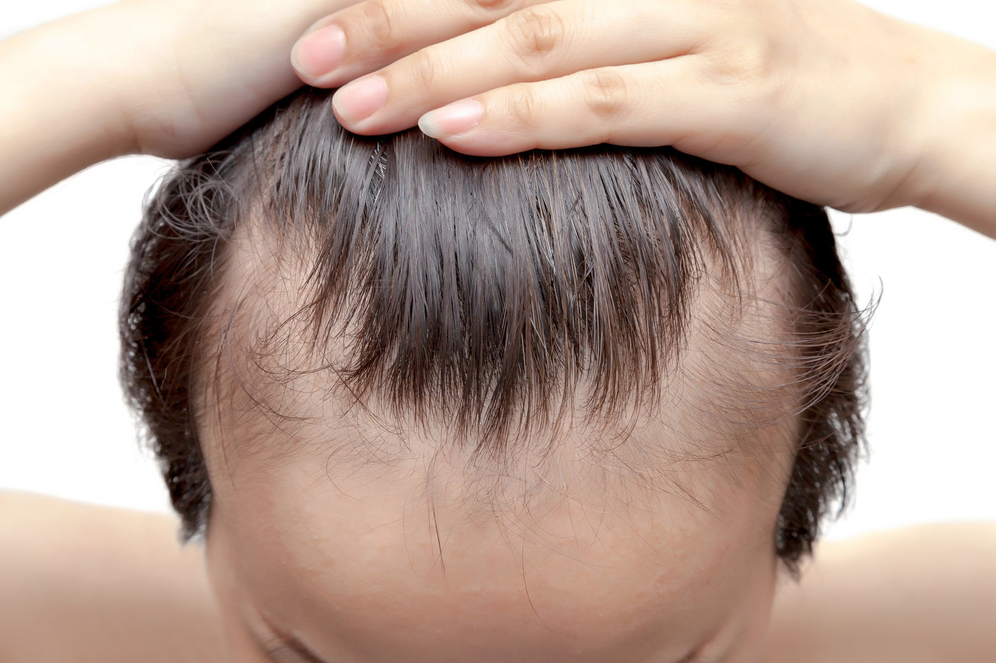 Why’s My Hair Thinning? 4 Main Factors Into Thinning Hair for Males & Females
