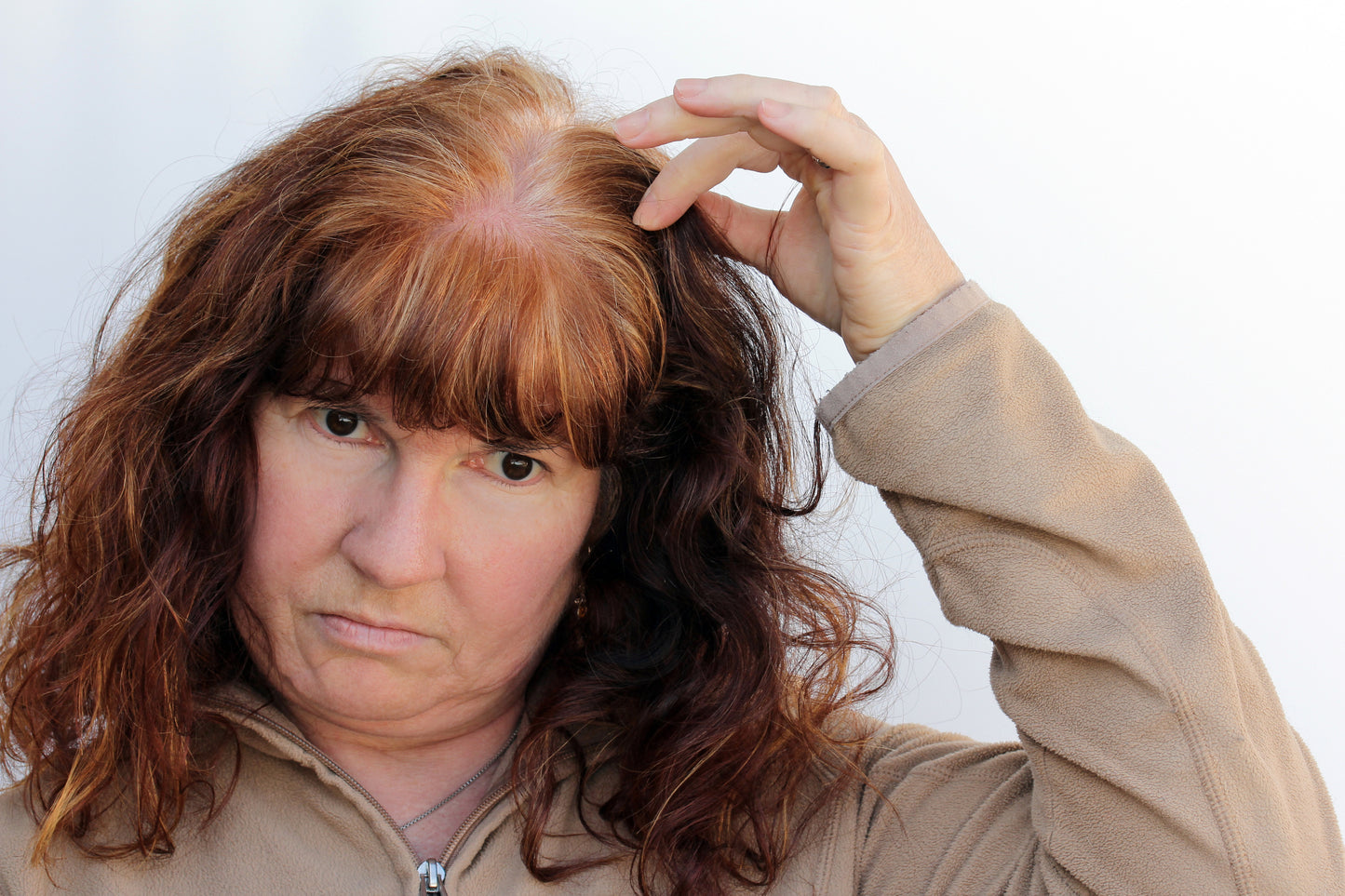 Menopause hair loss