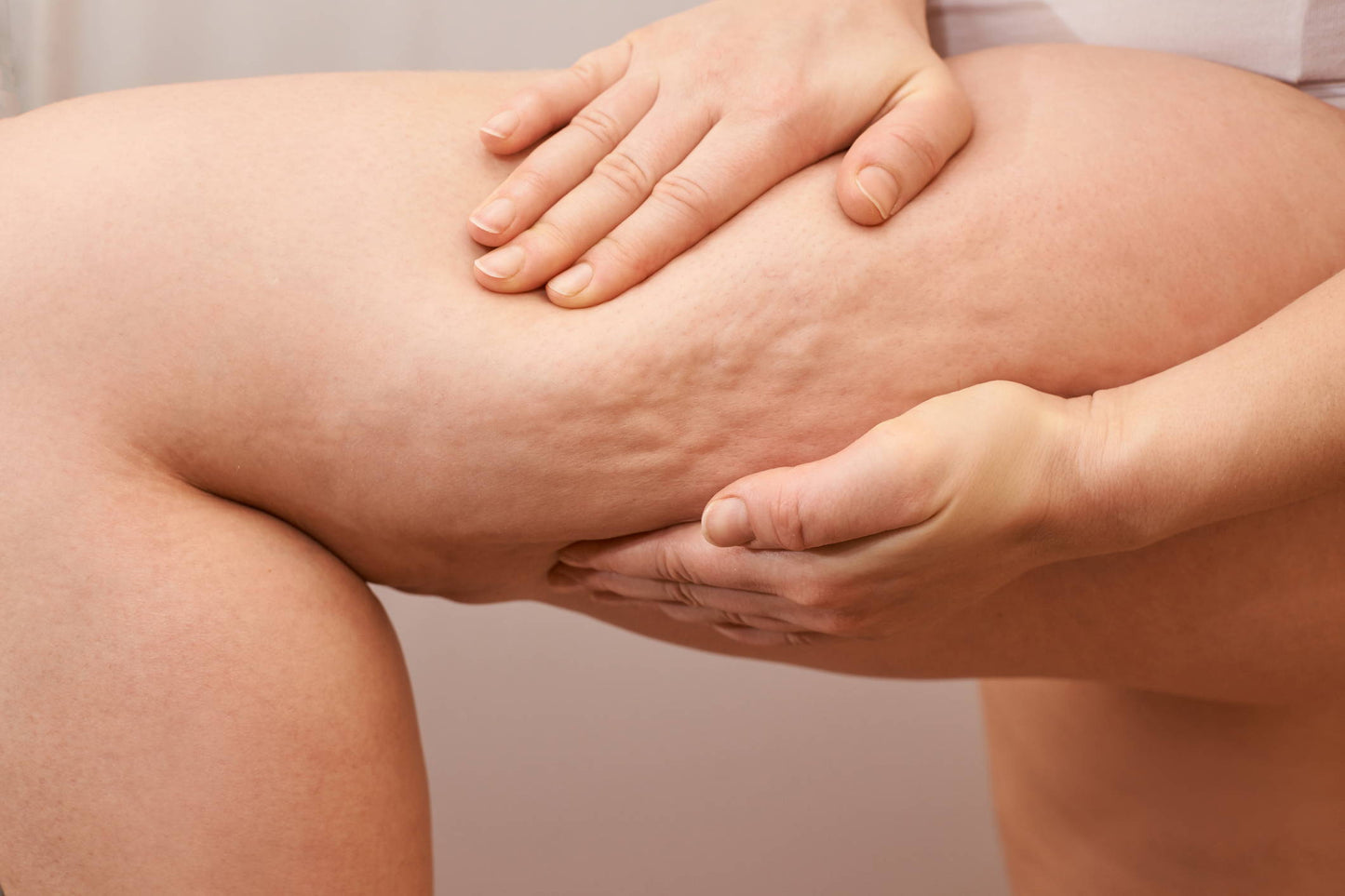 6 Effective Ways To Reduce Cellulite