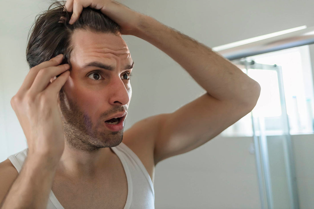 Why Is My Hairline So High? Causes & Solutions Explained
