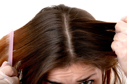 Is Ketoconazole Shampoo Good For Dandruff?