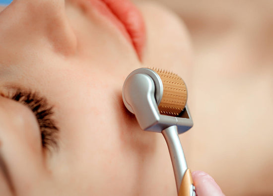 5 Ways the StimuRoller (Micro Needling) Helps Your Skin Look Beautiful