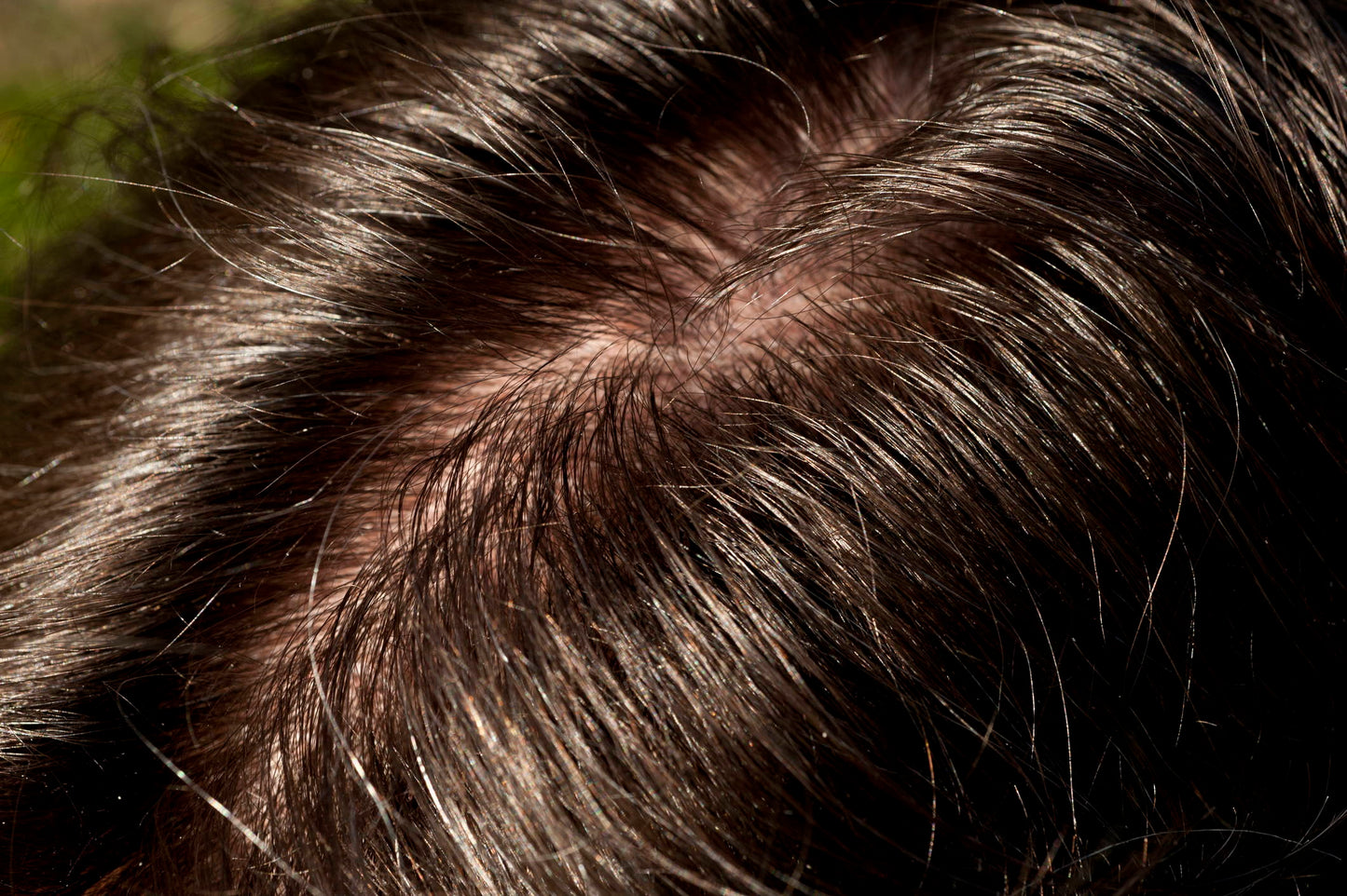 How To Get Rid Sebum Buildup On Your Scalp