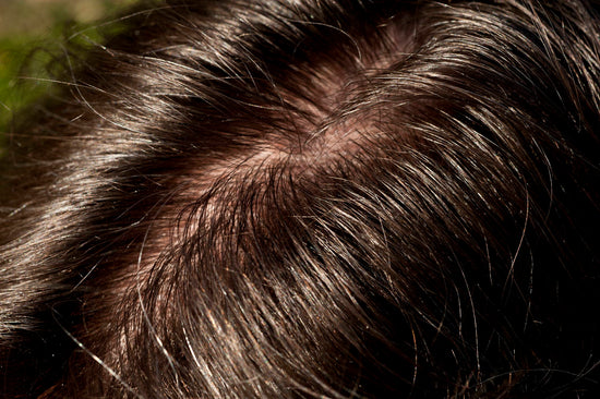 How To Get Rid Sebum Buildup On Your Scalp