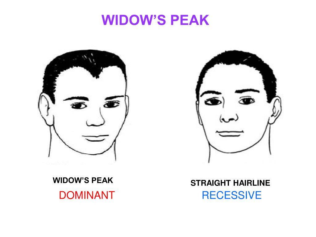 Why Do I Have a Widow's Peak Hairline?