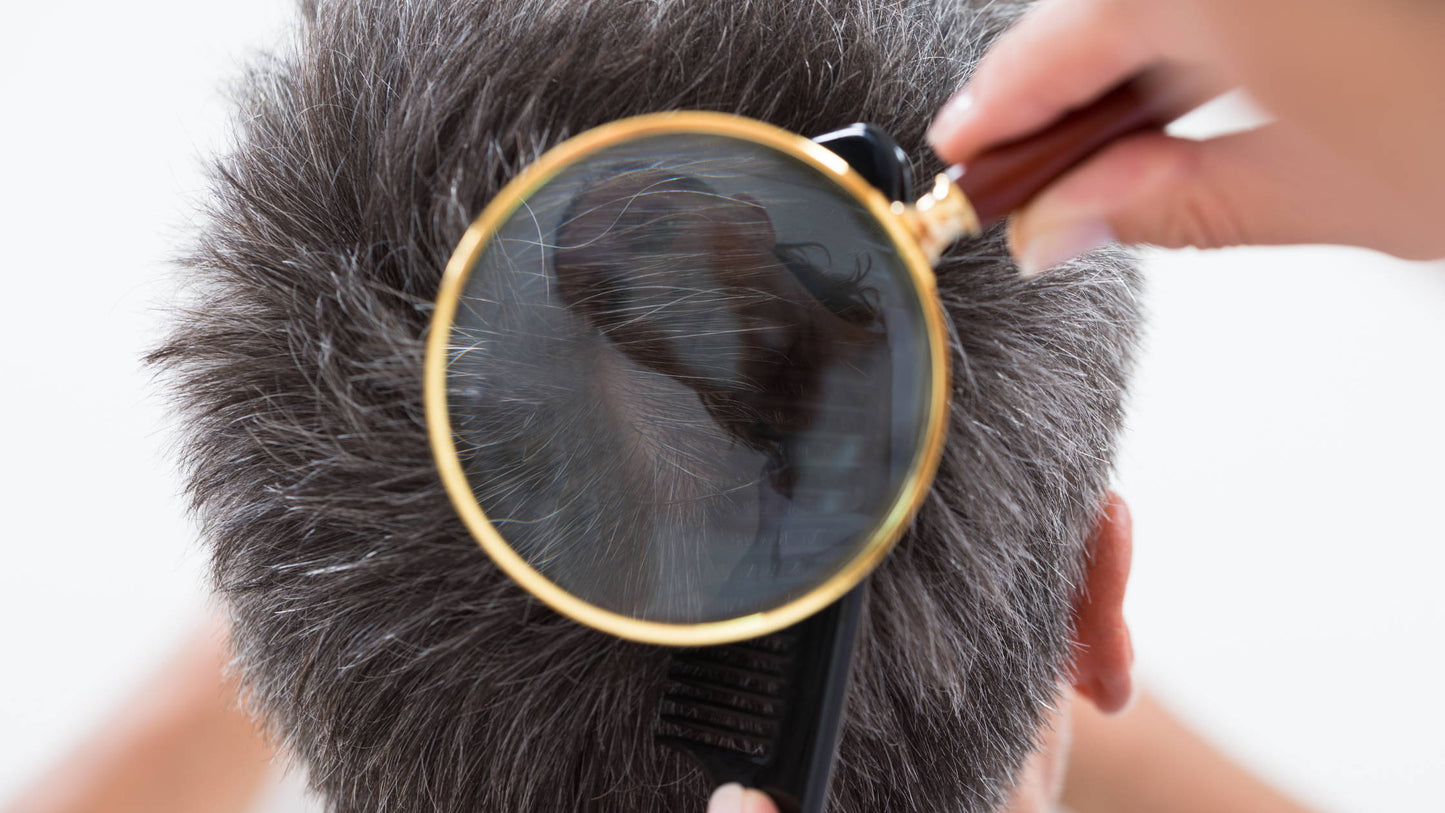 5 Steps To Identify Thinning Hair