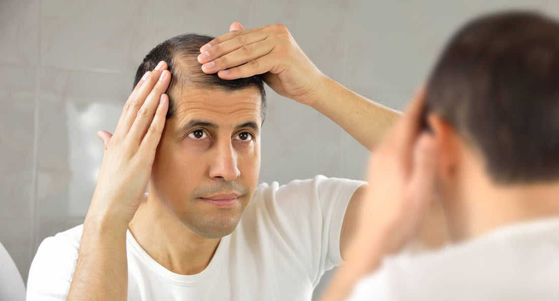 Does Telogen Effluvium Affect the Hairline?