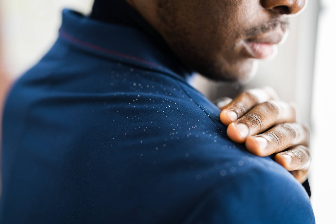 What's The Difference Between Dry Scalp Flakes vs. Dandruff?