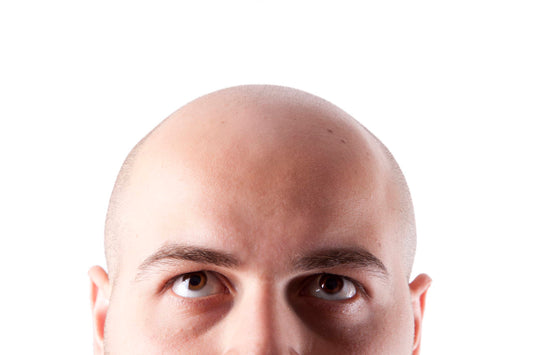 Can Minoxidil Regrow Hair in Bald Spots?