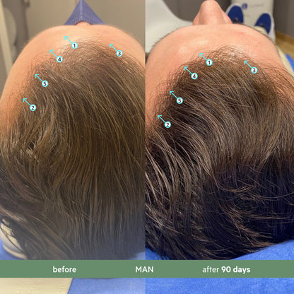 Revita.CBD | Super Antioxidant Hair DENSITY CBD Shampoo