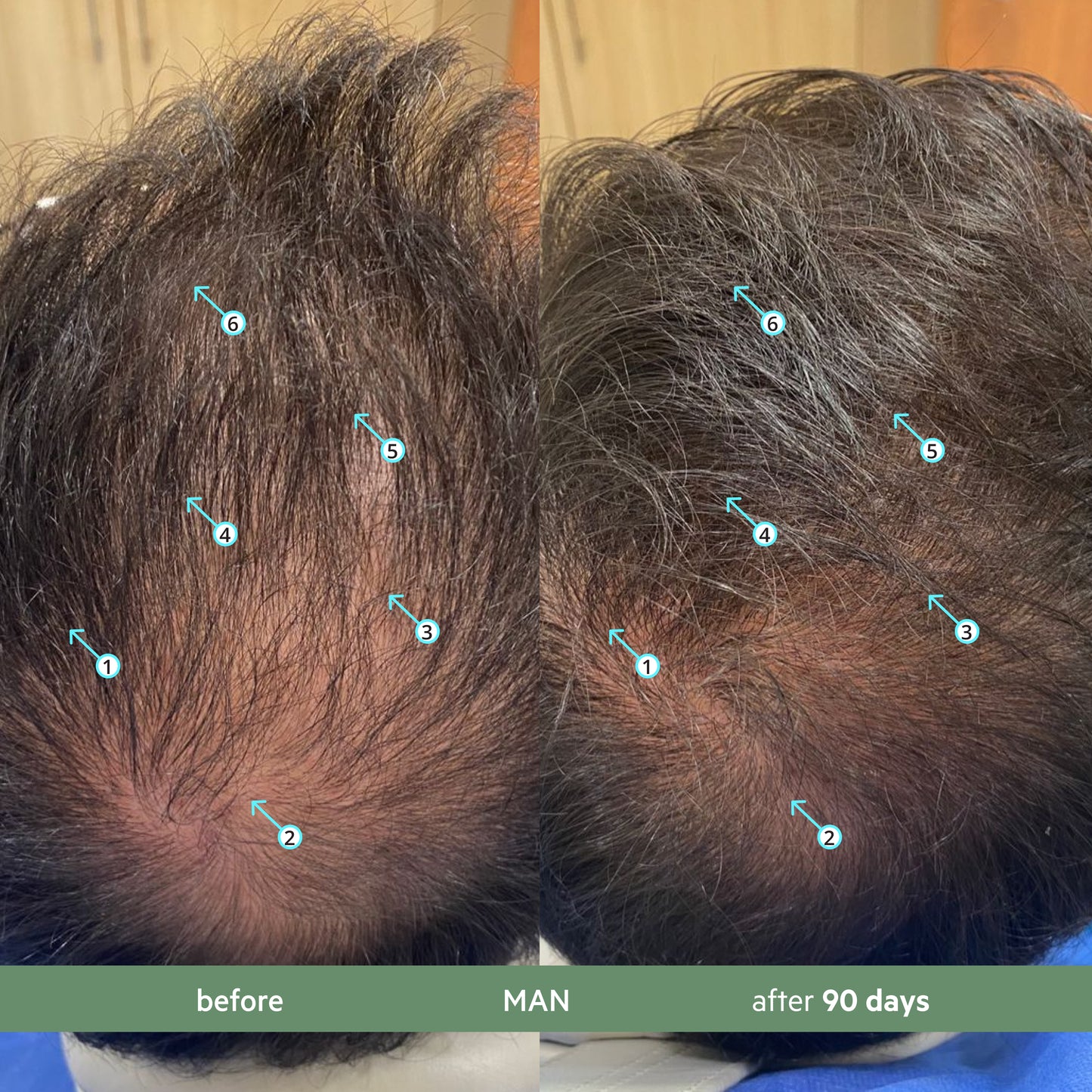 Revita.CBD | Super Antioxidant Hair DENSITY CBD Shampoo