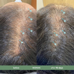 CBD Hair Density Kit