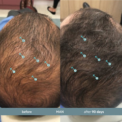 Revita.SOD | Advanced Antioxidant Protection for Hair Longevity