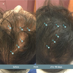 Revita.SOD | Advanced Antioxidant Protection for Hair Longevity