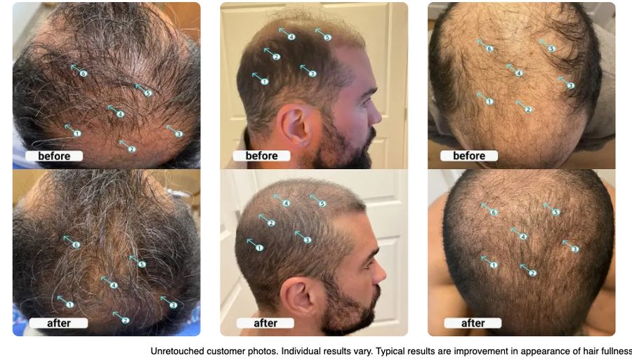 Fotos de antes y después de clientes de Spectral Men's
